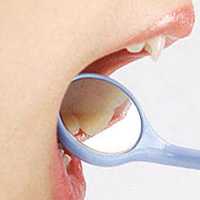 歯科用デンタルミラーで歯の裏をチェックする女性